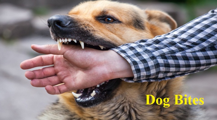 Does Homeowners Insurance Cover Dog Bites